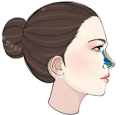 成都西区整形医院邓东伟医生简介:深耕鼻综合30年副主医师,专攻高难度鼻修复