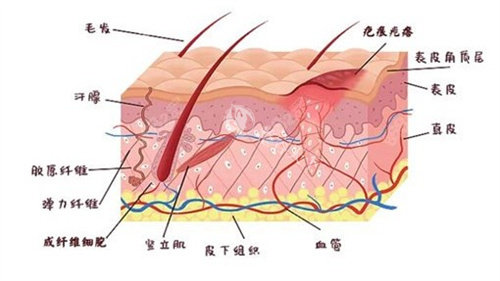 广州曙光疤痕胎记医院超正规！疤痕修复、胎记治疗技术硬，改善结果显著