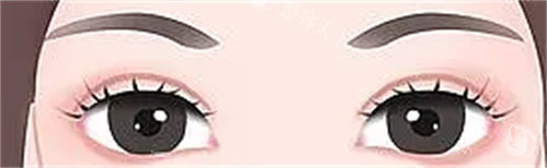 黄军伟双眼皮收费标准2025：埋线5000元起全明细