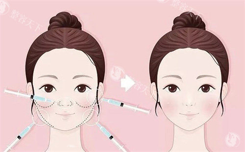 馒化针注射照片