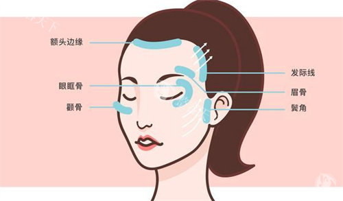 重庆李喆医生筋膜提升多少钱？全脸筋膜提升30000元左右、眼周筋膜提升16800元起、提眉手术5000元起