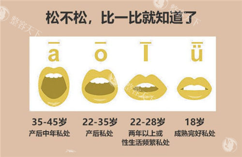 阴道松弛的程度对比