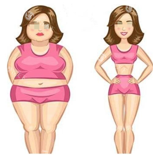 吸脂手术对比图