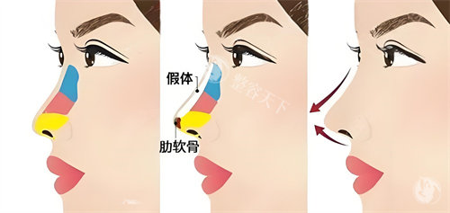 合肥经开区医美哪家好？韩宫整形鼻综合7800起_祛斑1980元_性价比较高！