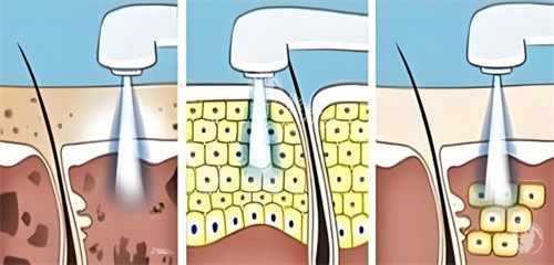 合肥经开区祛斑哪家好？韩宫整形1980元_骨胶原5600元_皮肤抗衰可选！