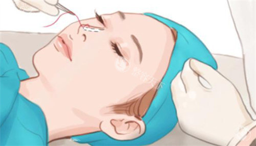 周帮国鼻综合靠谱吗？合肥韩宫医生_7800元起_原生鼻打造口碑佳！