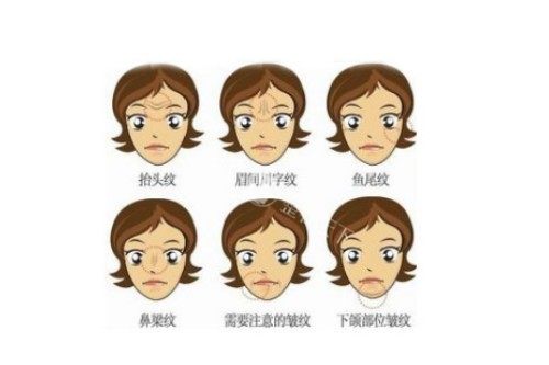 脸上皱纹