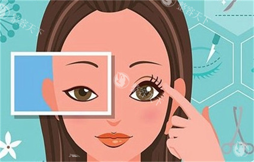 黄娟眼部整形怎么样？银川时光相伴主治医师_10余年经验_4000元起可约！