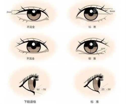 温州鹿城艺启美医疗美容门诊部超正规！个性化方案+术后护理细，变漂亮无套路