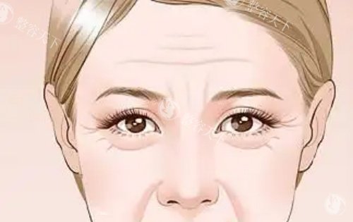 川字纹显老示意图