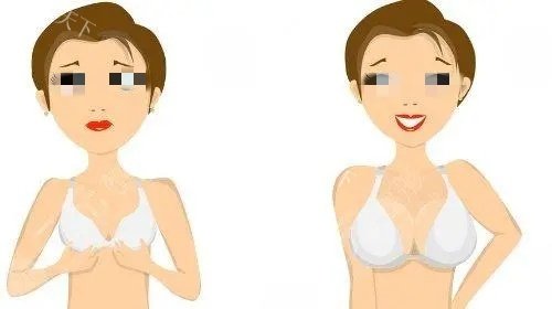 哈尔滨杨宇梓和刘一刀哪个假体隆胸好？杨宇梓自然水滴胸vs刘一刀修复强，附价格、技术等详细测评