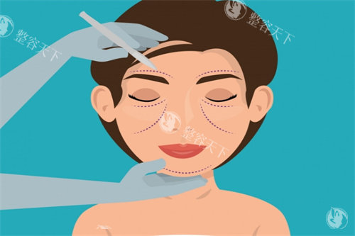 面部提升卡通图