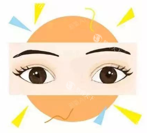 全切双眼皮结果图