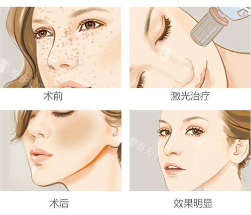 【榆林美立方整形医院】祛遗传斑靠谱吗？真实改善+医生方案一次说清！