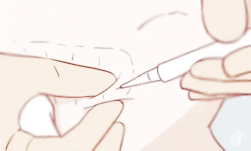 <span class='highlight'>溶脂针</span>