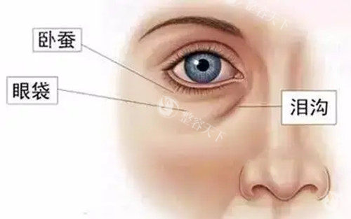眼周不同结构及名称示意图