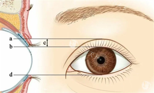 沈阳沈河腾采医疗美容如何？真实患者反馈，带你了解其口碑与服务品质！