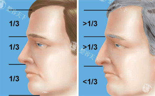 过长的鼻子和正常鼻子矫正对比