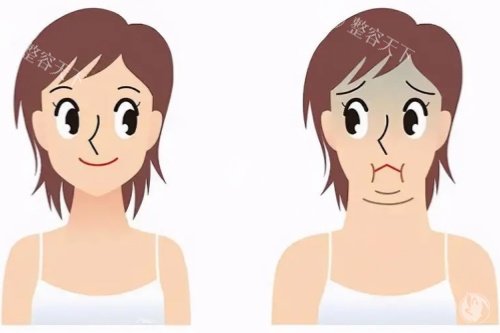 双下巴消除卡通对比图