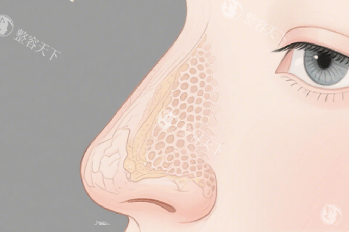 福州隆鼻多少钱？玻尿酸注射隆鼻3000元起、硅胶假体8000元起、膨体15000元起、鼻修复50000元起！