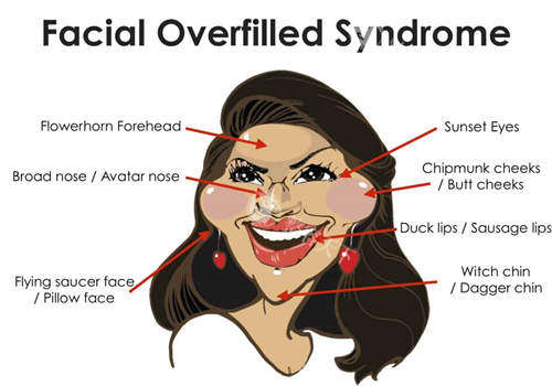 蒋铮铮全脸注射填充价格大公开！真实实例+避坑指南全解析！
