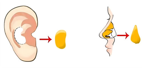 李保锴和张龙谁做鼻子更出色？看完这篇对比不纠结！