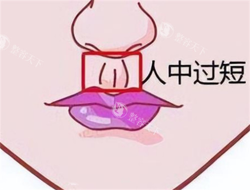 被重庆李泽人中缩短封神！没疤+形态超自然，显嫩十岁还不夸张，做完朋友都问在哪做的，附真实修养过程