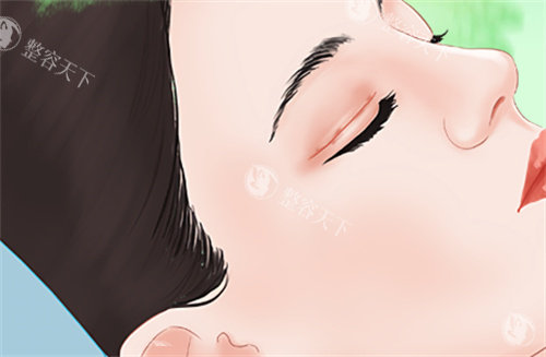 需要双眼皮修复的眼睛