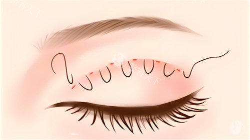 纠结厦门美莱还是欧菲？从背景实力到特色项目，为你深度剖析哪家更好！