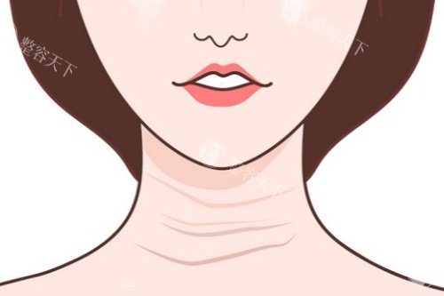 颈纹卡通图片展示
