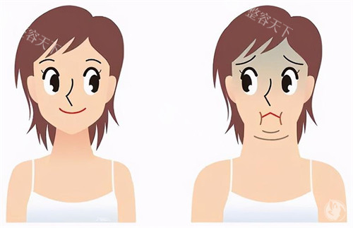 下巴宽大与正常对比动画图