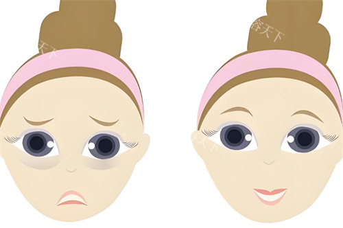 深圳福雅整形割眼袋怎么样？从技术口碑结果三方面深度剖析