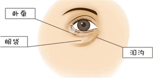 卧蚕眼袋和泪沟位置