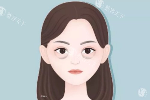 眼袋卡通图展示