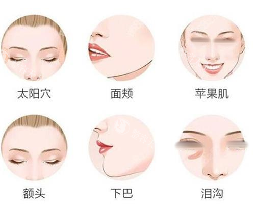 福州面部填充哪个医生好？温名赟、朱刚强、许喜雄、马美洲、余乐平、周秀峰医生出名且靠谱~