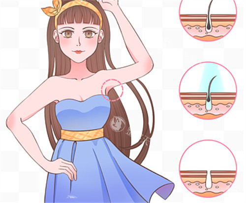 腋下脱毛前后毛囊对比图