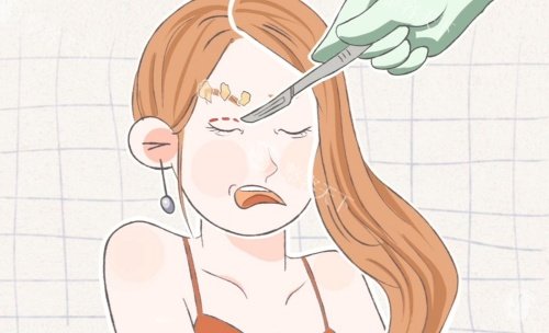 吕婧双眼皮闭眼无痕是真的吗？附吕婧医生双眼皮技术特点、价格与口碑实录