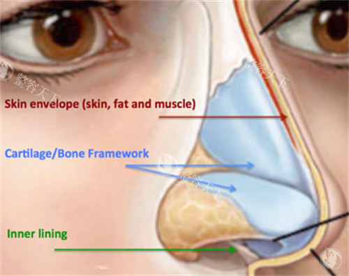 任东医生修复鼻子怎么样？自体软骨优先运用，避免排异风险，鼻梁挺拔+鼻尖柔软，触感外观双自然
