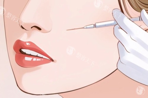 面部注射卡通一览