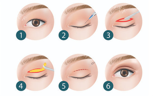 南昌双眼皮医院推荐2026！韩美/诺颜/鹏爱秀琪等8家靠谱机构风格+结果全参考