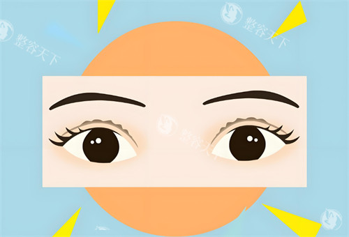 双眼皮睁开图
