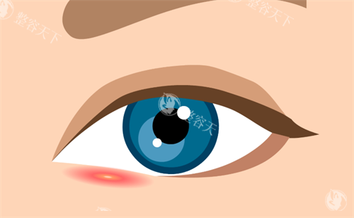 义乌秀壹医美具体位置？义乌市城西街道东河工商街23号，整形项目全覆盖