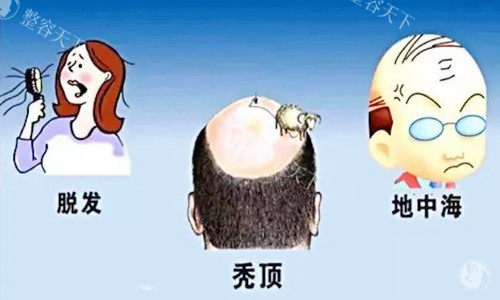 苏州百年植发医疗美容门诊部：专注植发领域，毛囊存活率高，术后自然逼真