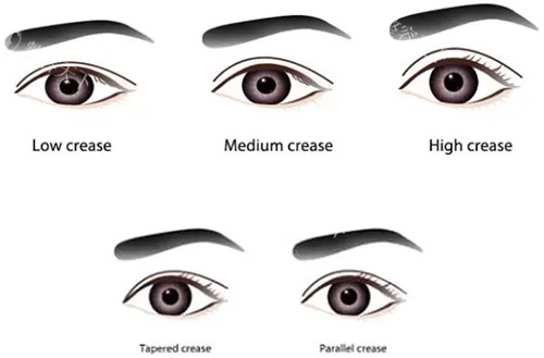 曲胜星范医疗美容门诊部口碑好不好？超赞！眼鼻整形技术优，结果自然不夸张，本地口碑佳