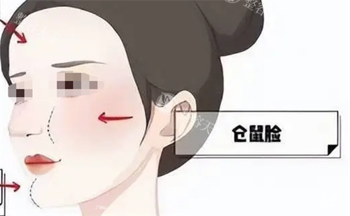 玻尿酸后馒化现象动画展示