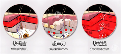 面部提升项目对比