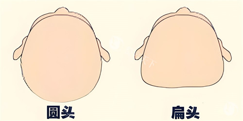 头部填充术前手术上方对比动画图