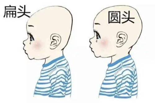 圆头、扁头对比图