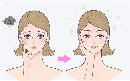 祛斑对比
