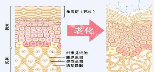 皮肤老化前后内部组织形态示意图